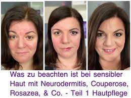 . that may involve persistent erythema with hyperplasia of sebaceous glands. Welche Pflege Bei Couperose Rosazea Neurodermitis Co
