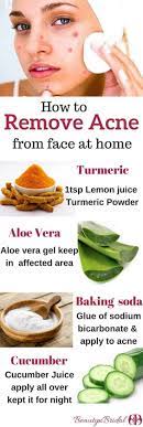 10 Home Remedies For Pimples Home Remedies For Pimples Natural Acne Remedies Home Remedies For Acne