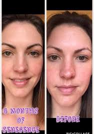 How did you achieve less makeup with good skincare?