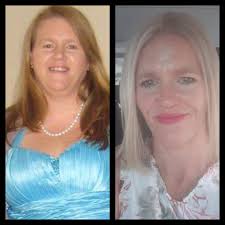 Surround yourself with supportive people for vision