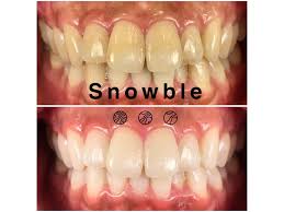 ホワイトニング専門歯科医院 Snowble