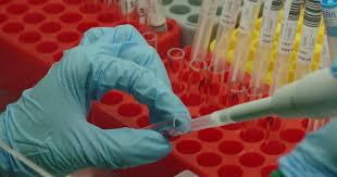 You don't have any symptoms and want a corona test and/or need a test confirmation for a trip? Preisdumping Bei Pcr Tests Plusminus Ard Das Erste