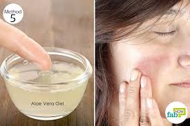 My face is covered in freckles, which i fully embrace. How To Get Rid Of Hyperpigmentation Top 10 Remedies To Get Clear Skin Fab How