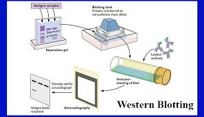 Maybe you would like to learn more about one of these? Western Blotting Introduction Principle And Applications