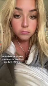 How to Get a Tan Without Suncream: ImgBurn Method