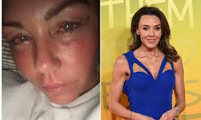 Michelle Heaton shares teary photo at the height of her alcohol addiction  battle as she reflects