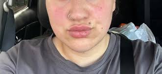 Turning 40 mystery illness symptoms