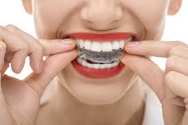 Per dentiere a apparecchi ortodontici.descrizione e caratteristiche> nuovo formato. Apparecchi Ortodontici Tipologie E Caratteristiche