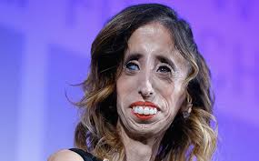 World's Ugliest Woman' says label was a 'blessing'