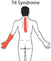 Related posts of upper back muscle diagram muscle anatomy app. Back Pain Upper Middle Right Left Sudden Severe Chronic Ehealthstar