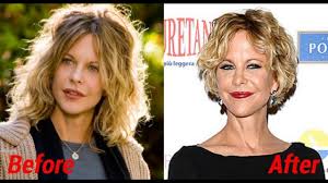 Find more shocking photos of celebrity plastic surgery, breast implants, facelifts and more at . Meg Ryan S Plastic Surgery Too Noticeable Youtube
