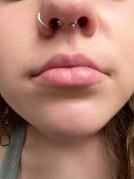 Have Had Septum Pierced For 2 Days Now It S Crooked Like This And When I Ve Tried To Move It To Be Even Gently Of Course It Hurts Is It Normal For It