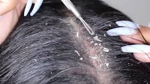 Here are the ideal hours or time frame advisable for you to leave rice water on your hair; Can Rice Water Go Bad Rice Water Benefits Hello Lidy