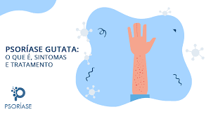 Normalmente, a psoríase gutata surge após uma infecção na garganta ou infecção estreptocócica. Facebook
