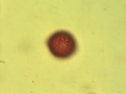 Image result for Bridelia mollis