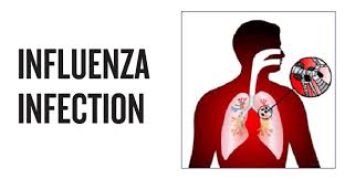 Am j respir crit care med. Types Of Flu Causes Symptoms Prevention Tips