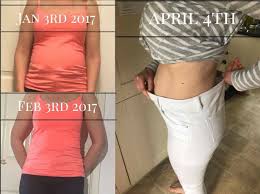 Pin On Before And After Weightloss Stories