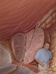 Image result for Chronic Bacterial Prostatitis