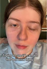 How Can I Do The Doll Wink