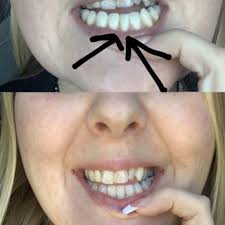 MICHAEL SKIDMORE, DMD