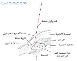 مؤسسة إبصار الصحية الجلوكوما الغلوكوما المياه الزرقاء الزرق الماء الاسود في العين اللص الصامت