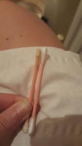 Mancho Marron Claro Y Test Positivo Claro 3 Dias Antes Primeros Sintomas Babycenter