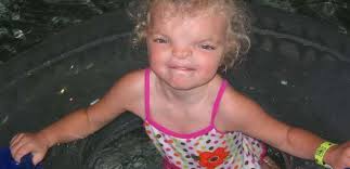 Girl requests special visitors following surgery