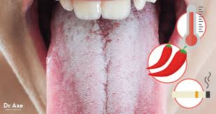 Why Do I Have A White Tongue Your Body S Trying To Tell You Something Oral Hygiene Tongue Health White Tongue Causes