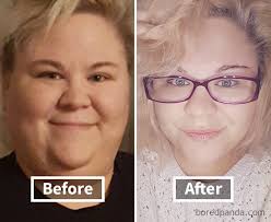 128 Surprising Photos of Face Fat Loss Before and After Weight Loss
