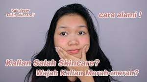 Check spelling or type a new query. Cara Alami Menghilangkan Kemerahan Akibat Salah Skincare Desty Yufenti Youtube