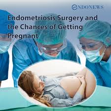 Pin On Endometriosis Pelvic Pain Blog