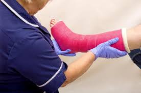 Exercises While In Bed From A Broken Ankle Livestrong Com Broken Foot Ankle Fracture Broken Ankle Recovery