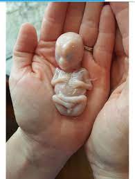 Telesur Ar Twitter Impacta Foto De Bebe A Las 15 Semanas La Activista Brenda Del Rio Compartio Esta Impresionante Imagen De Un Bebe Formado A Las 15 Semanas De Gestacion Comunmente Usado