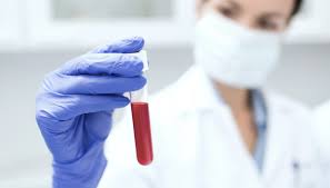 La piastrinopenia può manifestarsi anche asintomatica, ovvero in assenza di sintomi riconducibili ad essa e quindi difficile da diagnosticare. Piastrinopenia Cos E E Come Si Riconosce Dilei