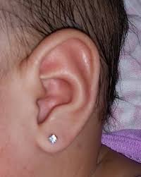 Uneven Earpiercing Babycenter