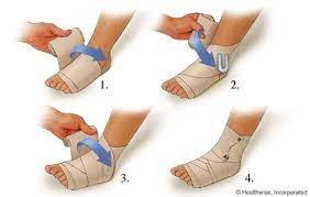 What Do I Do To Treat A Sprained Ankle Treating A Sprained Ankle Sprained Ankle Sprain