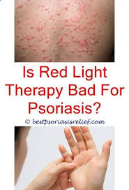 Psoriasis Revolution Whatisplaquepsoriasis Crema Casera Para Psoriasis Psoriasis Rash Pictures Typesof Plaque Psoriasis Treatment Psoriasis Severe Psoriasis