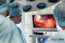 Laparoskopik Kist Ameliyati Nasil Yapilir