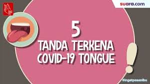 Sehingga kini pihak perubatan masih bertungkus lumus mencari penawar dan vaksin bagi menghentikan dengan kadar segera virus penyakit ini kerana telah melumpuhkan keseluruhan. Videografis 5 Tanda Anda Terkena Covid 19 Tongue Youtube