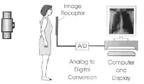 Schematic Diagram Of A Digital Radiography System