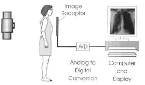 schematic diagram of a digital radiography system