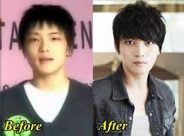 Kim Jaejoong Plastic Surgery Before And After Cosmetic Surgery Plastic Surgery Nose Job
