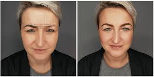 Lorraine Bond (0ftecpext9pev2a)