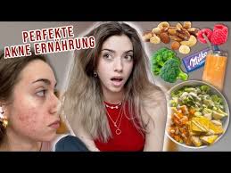 1 TAG nur AKNE FREUNDLICHE REZEPTE essen und das ist passiert..