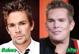 Mark mcgrath is on facebook. Mark Mcgrath Before And After Plastic Surgery Plastic Surgery Celebrity Memes Celebrity Plastic Surgery