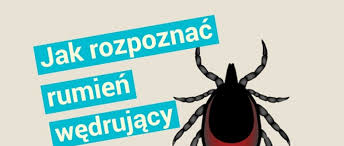 Początkowo w miejscu ukąszenia pojawia się zaczerwieniona grudka, która przechodzi w. Rumien Po Kleszczu Jak Wyglada Rumien Wedrujacy I Ile Sie Utrzymuje Zdjecia Mamotoja Pl