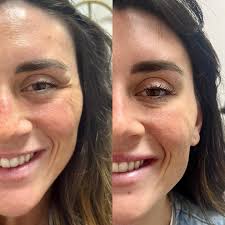 Elevate IV Hydration & Aesthetics