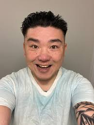 Is the lines down the left side fixable ?