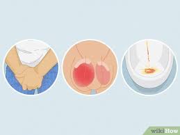 Image result for chlamydia symptoms