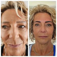 Georgiete staan saam